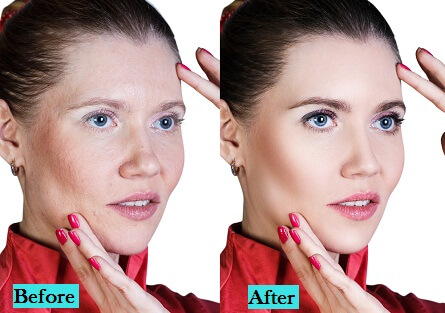 best-anti-ageing-treatment-in-pune