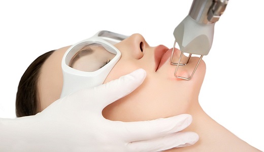 best-CO2-Laser-peels-treatment-in-pune-india