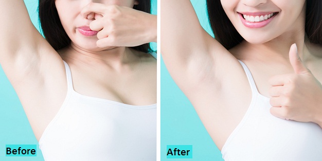 best-excessive-sweating-treatment-in-pune