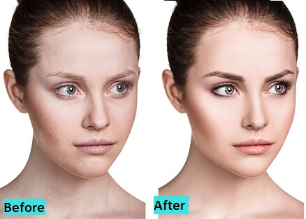 best-face-lifts-in-pune